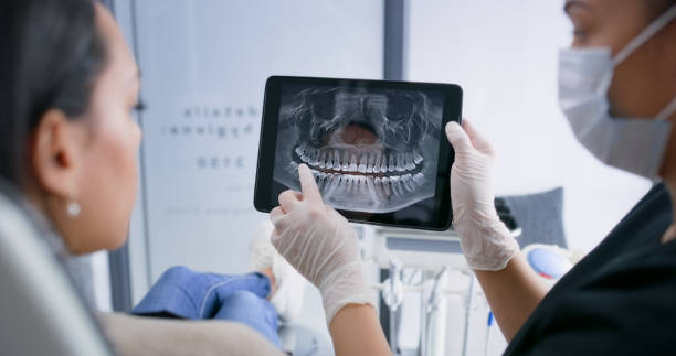 Licensed Tooth Extraction service in Clinton, UT - Smile Center Dentistry